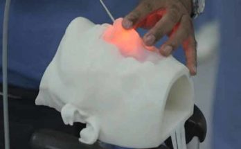Aplicaciones de la impresión 3D en Medicina